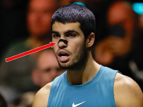 HiStrips nasal strips for athletes — do nasal strips actually work?