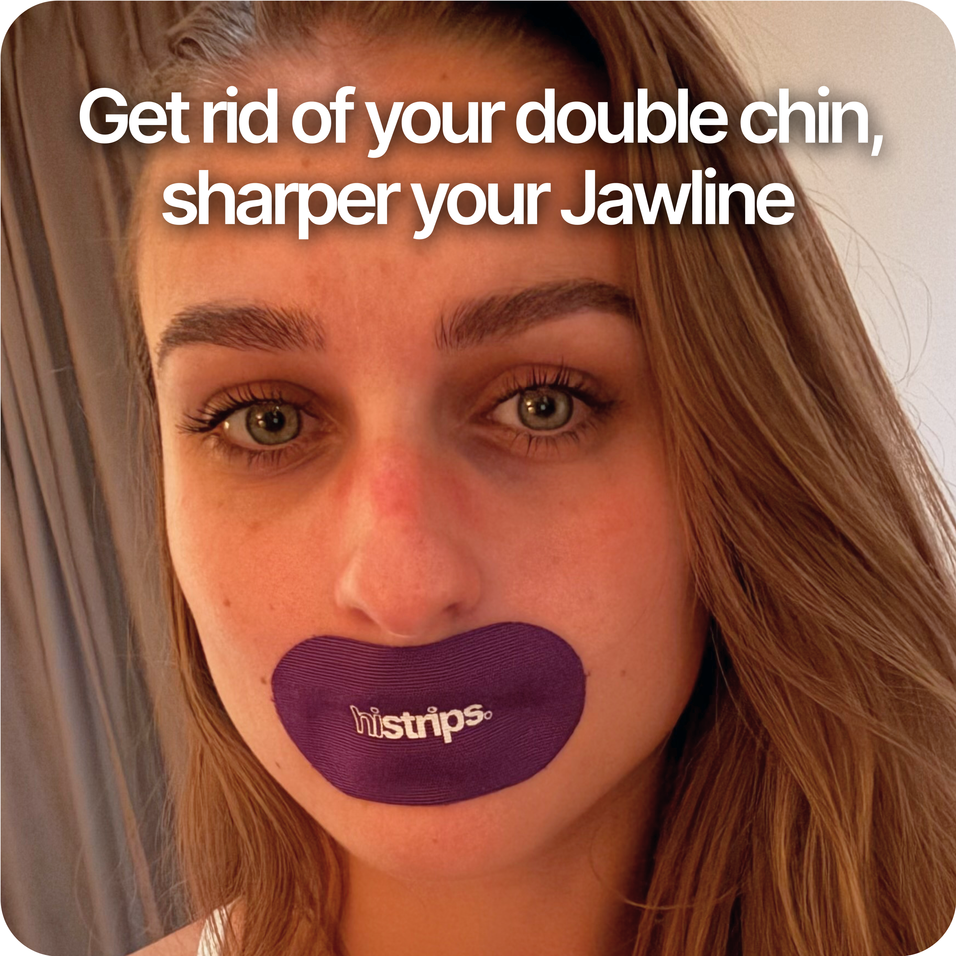 Aesthetic solution for a defined jawline and elimination of double chin