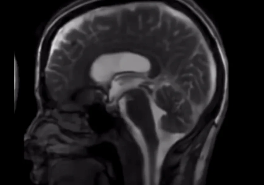 The Art of Nasal Breathing