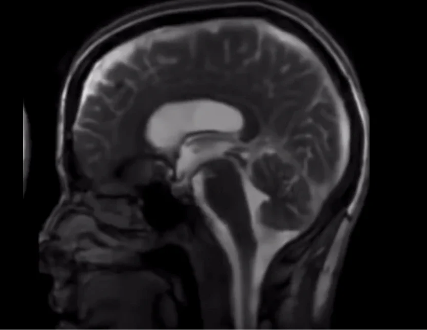 The Art of Nasal Breathing